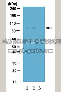 merck millipore,默克密理博,06-1340,Anti-phospho-IKK-epsilon (Ser172) Antibody