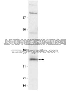 merck millipore,默克密理博,06-137,Anti-Cyclin D Antibody merck millipore,默克密理博,06-137,Anti-Cyclin D Antibody