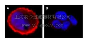 merck millipore,默克密理博,06-229,Anti-phospho-erbB-2/HER-2 (Tyr1248) Antibody