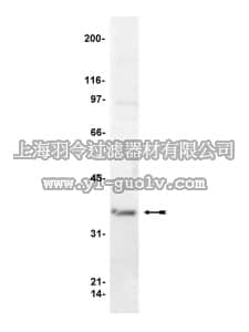 merck millipore,默克密理博,06-238,Anti-Gβ Antibody