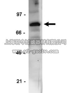 merck millipore,默克密理博,06-318,Anti-TGFβR Type II Antibody, CT