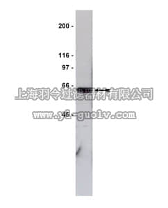 merck millipore,默克密理博,06-332,Anti-GST Tag Antibody merck millipore,默克密理博,06-332,Anti-GST Tag Antibody
