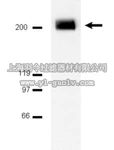 merck millipore,默克密理博,06-495,Anti-PDGFRβ Antibody merck millipore,默克密理博,06-495,Anti-PDGFRβ Antibody