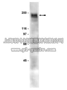 merck millipore,默克密理博,06-498,Anti-PDGFRβ Antibody