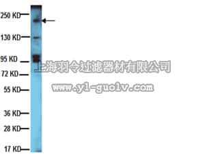 merck millipore,默克密理博,06-562,Anti-erbB-2/HER-2 Antibody