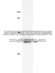 merck millipore,默克密理博,06-583,Anti-Lck Antibody