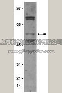 merck millipore,默克密理博,06-629,Anti-Estrogen Receptor β Antibody