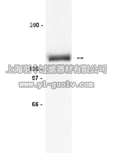 merck millipore,默克密理博,06-638,Anti-Tyk2 Antibody