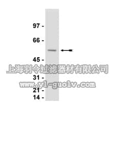 merck millipore,默克密理博,06-661,Anti-Calreticulin Antibody