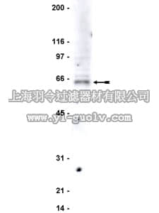 merck millipore,默克密理博,06-754,Anti-WASP Antibody