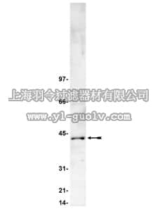 merck millipore,默克密理博,06-873,Anti-Casein Kinase 2 Antibody