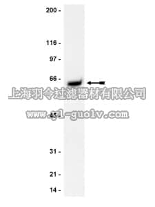merck millipore,默克密理博,06-885,Anti-Akt1/PKBα Antibody, PH domain,