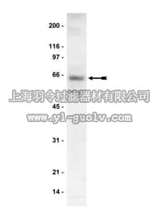 merck millipore,默克密理博,06-926,Anti-p70 S6 Kinase (S6K) Antibody