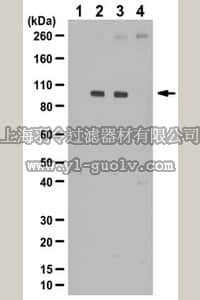 merck millipore,默克密理博,06-937-I,Anti-phospho-STAT6 Antibody (Tyr641)