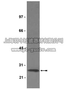 merck millipore,默克密理博,06-984,Anti-Mn-SOD Antibody