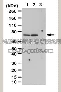 merck millipore,默克密理博,07-018-I,Anti-phospho-p70 S6 Kinase (Thr389) Antibody