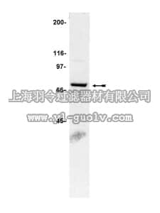 merck millipore,默克密理博,07-024,Anti-gp91-phox Antibody
