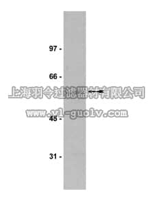 merck millipore,默克密理博,07-067,Anti-Calcineurin/PP2B Aα Antibody