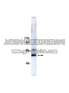 merck millipore,默克密理博,07-068,Anti-Calcineurin/PP2B Aβ Antibody