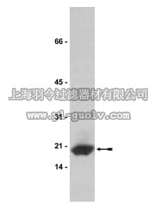 merck millipore,默克密理博,07-069,Anti-Calcineurin/PP2B B Antibody