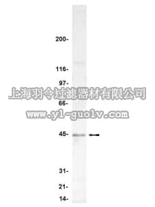 merck millipore,默克密理博,07-095,Anti-PP2A-methylesterase/PME-1 Antibody