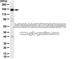 merck millipore,默克密理博,07-1010,Anti-CtIP (RBBP-8) Antibody
