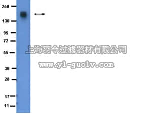 merck millipore,默克密理博,07-102,Anti-IGF2BP1/2 Antibody