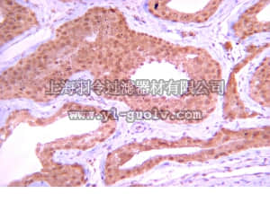 merck millipore,默克密理博,07-1217,Anti-PP1β Antibody