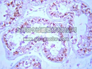 merck millipore,默克密理博,07-1219,Anti-PP2A Antibody, B β subunit