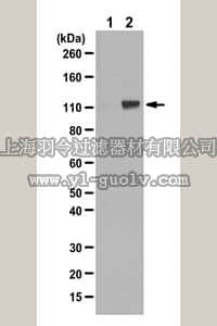 merck millipore,默克密理博,07-1375,Anti-phospho-Androgen Receptor (Ser81) Antibody