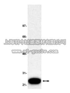 merck millipore,默克密理博,07-137,Anti-RKIP Antibody