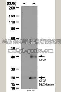 merck millipore,默克密理博,07-1386,Anti-Connective Tissue Growth Factor Antibody