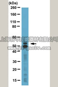 merck millipore,默克密理博,07-1406,Anti-GLUT-5 Antibody, a.a. 490-502