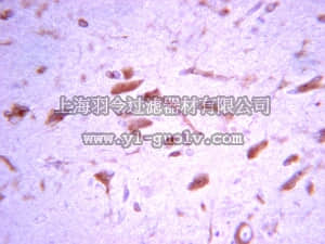 merck millipore,默克密理博,07-1415,Anti-mTOR (catalystic domain) Antibody