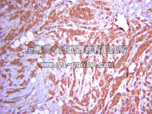 merck millipore,默克密理博,07-1476,Anti-MEKK1 Antibody