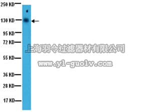 merck millipore,默克密理博,07-1489,Anti-Phospho-JAK1 (TYR1022/1023) Antibody