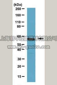 merck millipore,默克密理博,07-1492,Anti-Calcineurin Aα Antibody