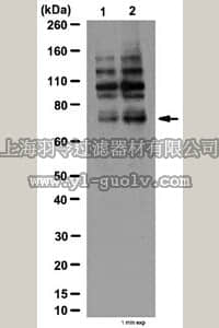 merck millipore,默克密理博,07-1520,Anti-phospho-Grb10 (Ser501/Ser503) Antibody