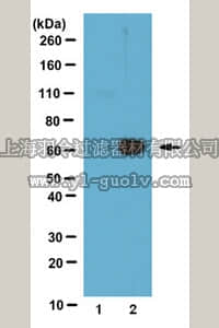 merck millipore,默克密理博,07-1575,Anti-phospho HDAC1 (Ser421/Ser423) Antibody