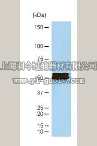 merck millipore,默克密理博,07-1580,Anti-KLF5 (Krüppel-like factor 5) Antibody