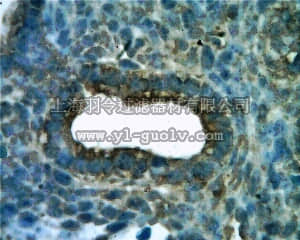 merck millipore,默克密理博,07-158,Anti-KDR/Flk-1/VEGFR2 Antibody