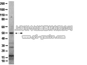 merck millipore,默克密理博,07-1602,Anti-IRAK4 Antibody, CT
