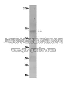 merck millipore,默克密理博,07-169,Anti-iPLA2 Antibody
