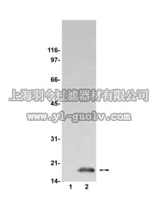 merck millipore,默克密理博,07-172,Anti-FHIT (fragile histidine triad) Antibody