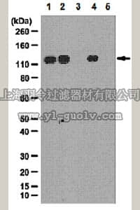 merck millipore,默克密理博,07-1817,Anti-phospho-SRPK2 (Ser494) Antibody