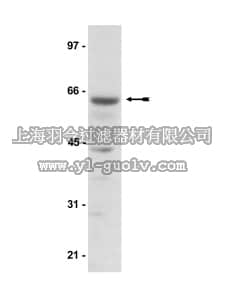 merck millipore,默克密理博,07-181,Anti-AMPK α-pan Antibody