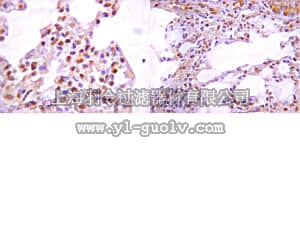 merck millipore,默克密理博,07-2065,Anti-SET2 Antibody