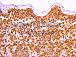 merck millipore,默克密理博,07-2068,Anti-PRDM2 Antibody (RIZ1)