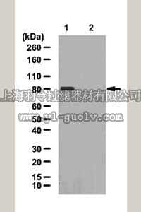merck millipore,默克密理博,07-2117,Anti-phospho-RSK1/2 Antibody (Ser363) (Turn motif)