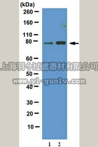 merck millipore,默克密理博,07-2126,Anti-phospho-FOXO1 Antibody (Thr24)